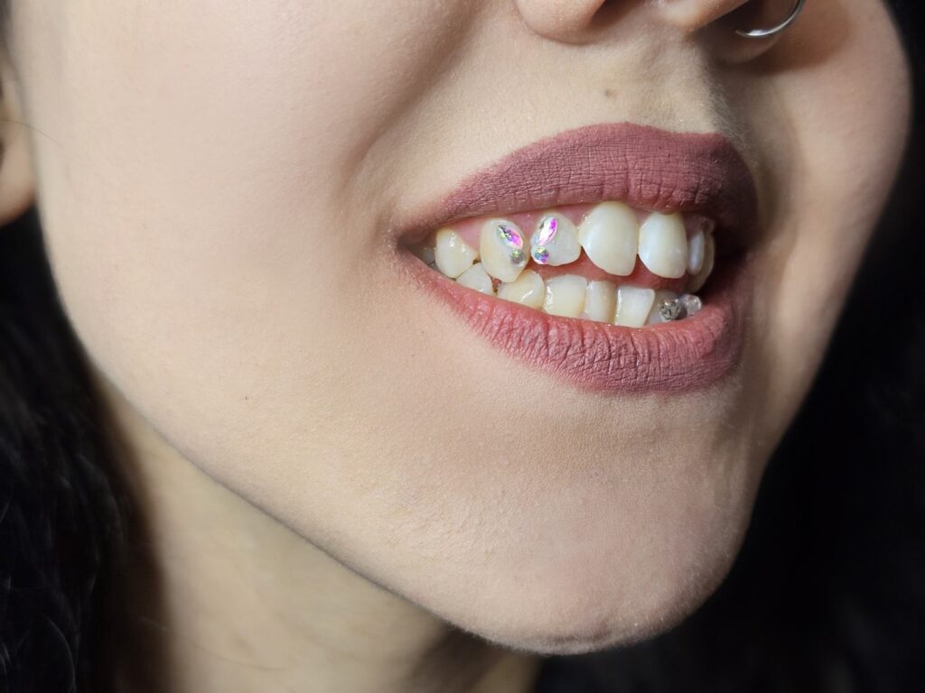 Tooth gems - motyl