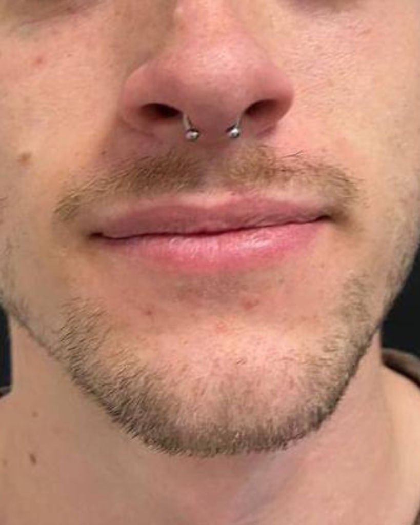 Septum piercing